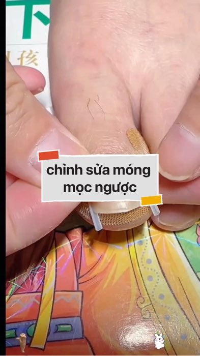 chỉnh sửa móng tay chân mọc ngược #VideohangDoiSong#ShopeeVideo#ShopeeCreator #LuotVuiMuaLien#KOLUyTin#Videomuasam #SandealcungKOL #diumi232