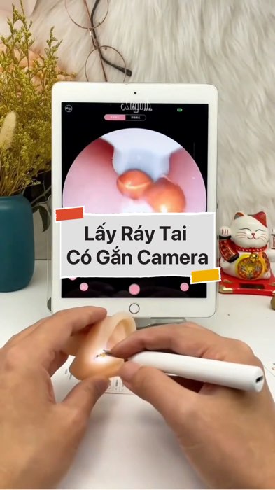 Dụng Cụ Lấy Ráy Tai Có Gắn Camera #VideohangDienTu#shopeestyle#ShopeeVideo#ShopeeCreator#LuotVuiMuaLien#KOLUyTin#Videomuasam #SandealcungKOL #diumi804